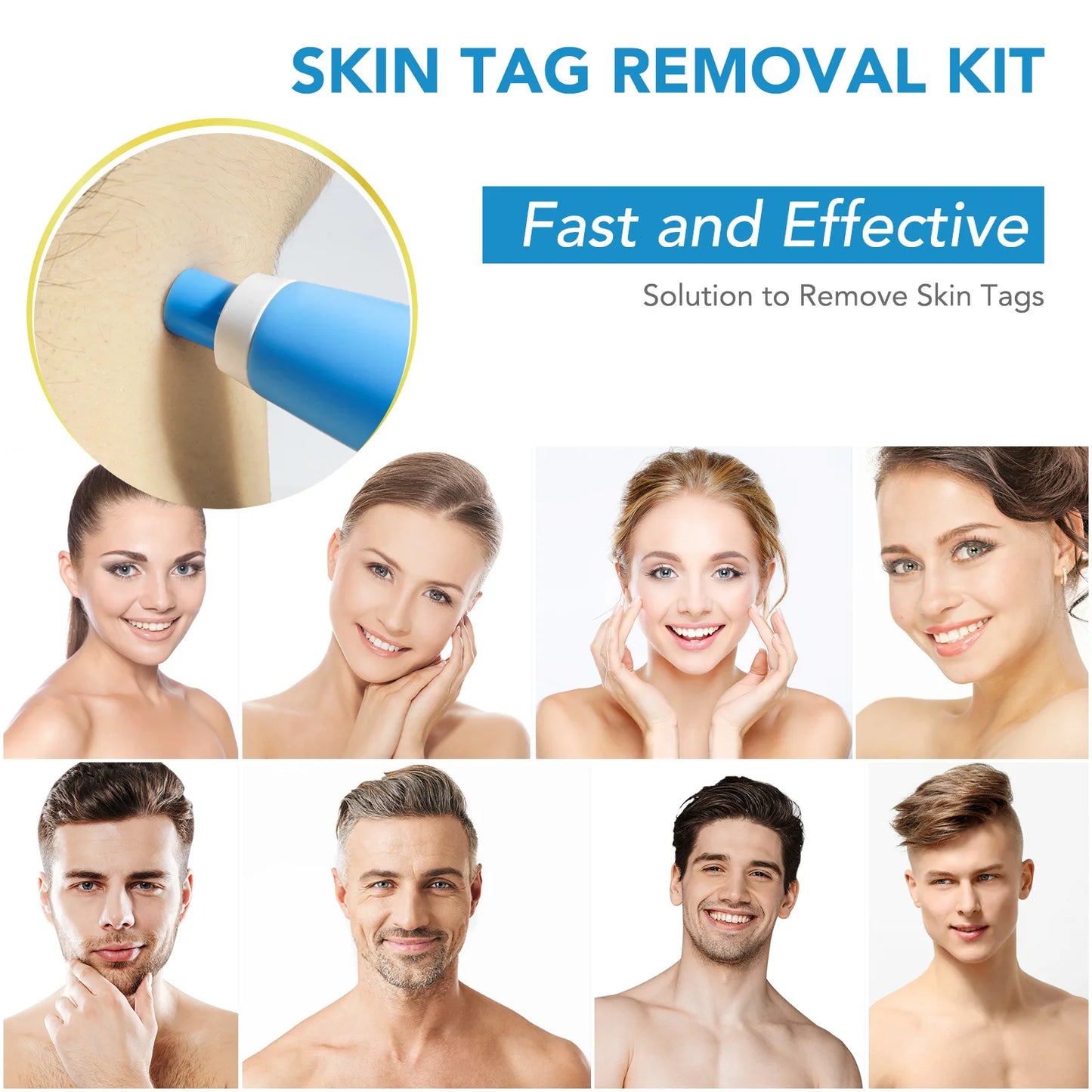 2 IN 1 Auto Skin Tag Remover Kit